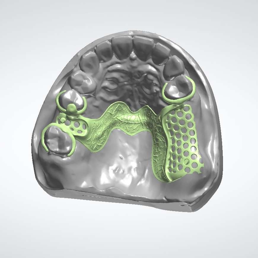 Dentiste utilisant un scanner intra-oral TRIOS dans son cabinet